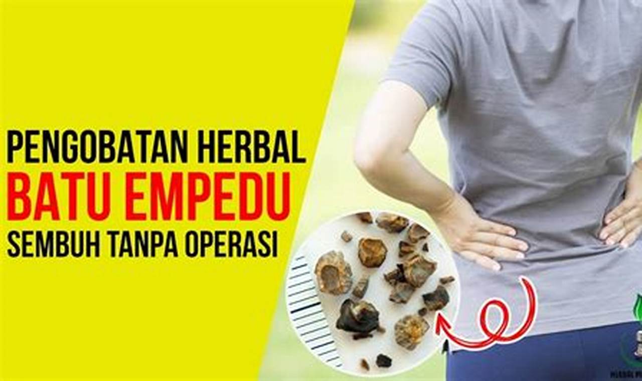 cara mengatasi batu empedu